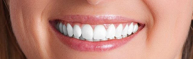 Tooth filling